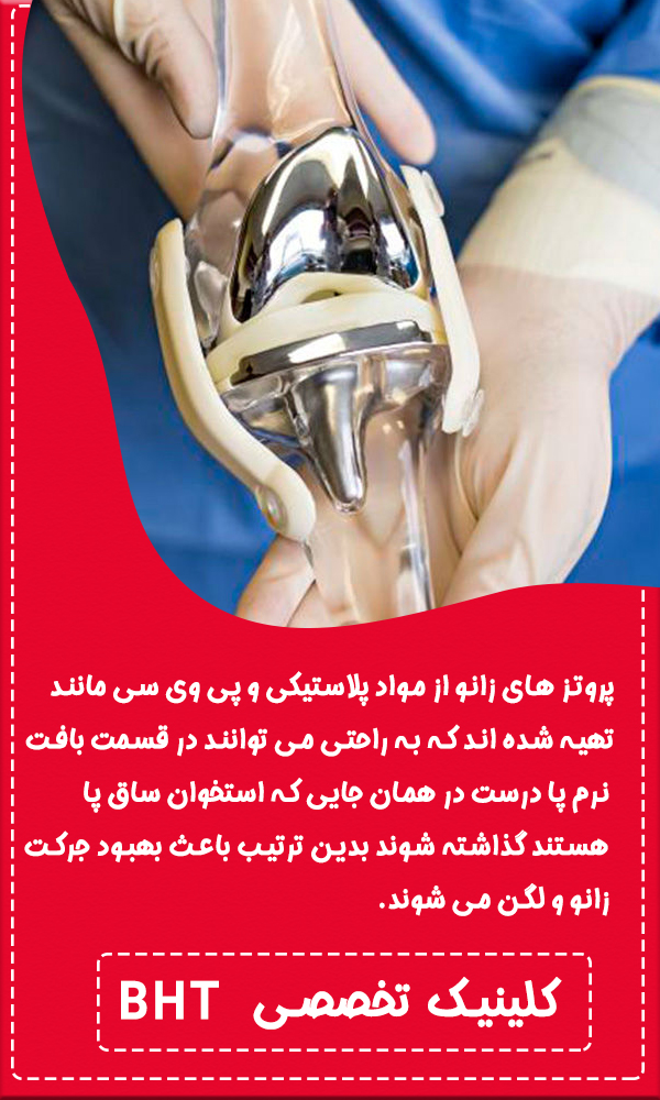 همه چیز درمورد پروتز زانو